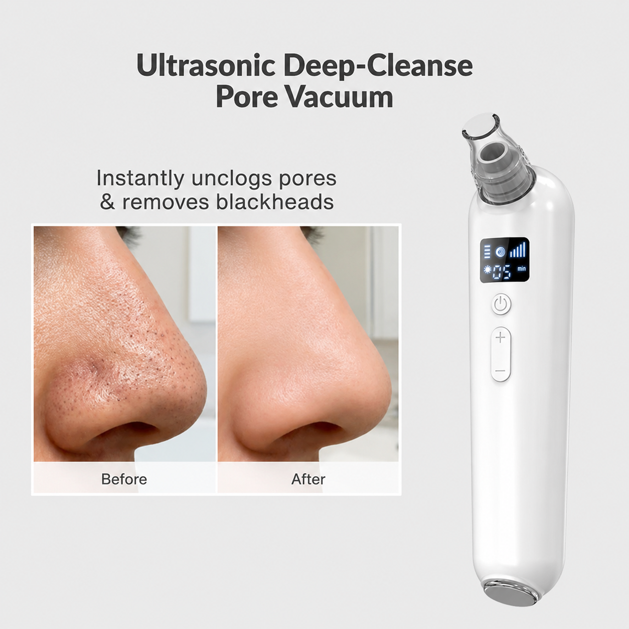 Microcrystalline Electric Blackhead Remover