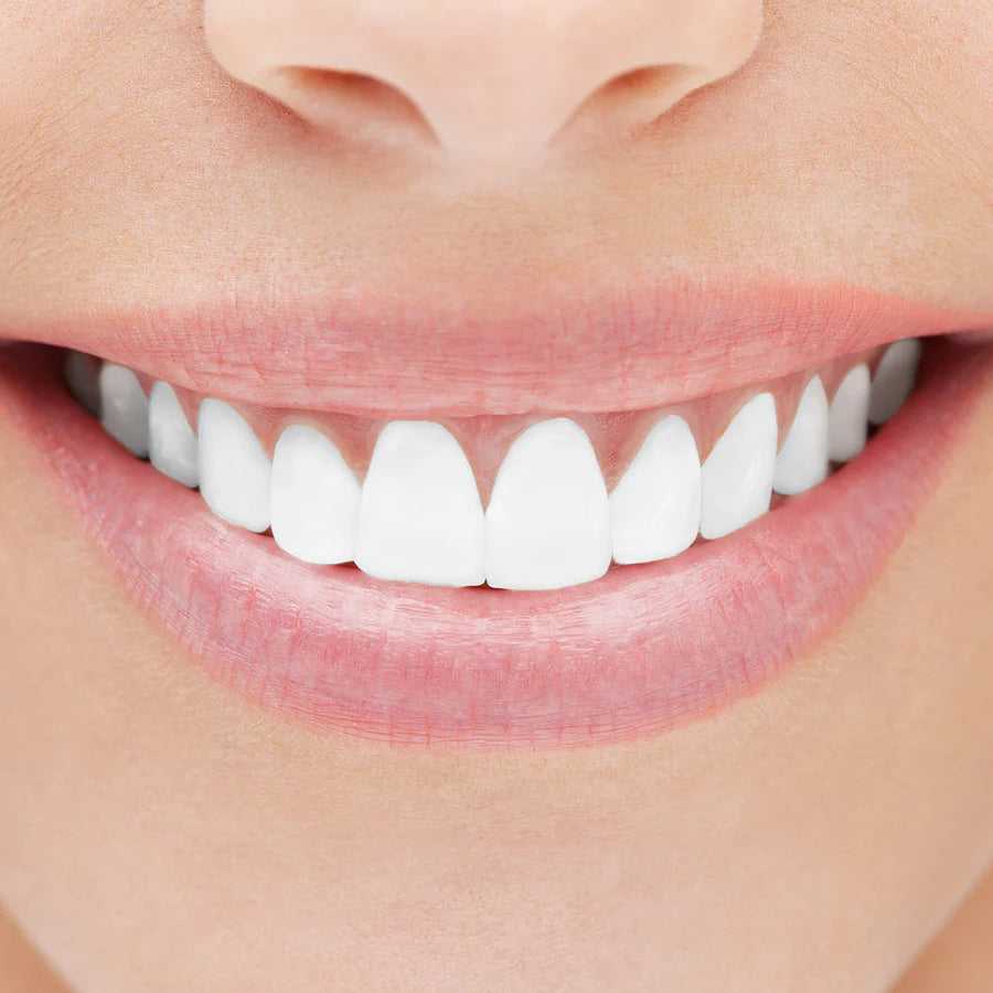 NeuraGlow LED Teeth Whitening Kit – Professional At-Home Teeth Whitening Device