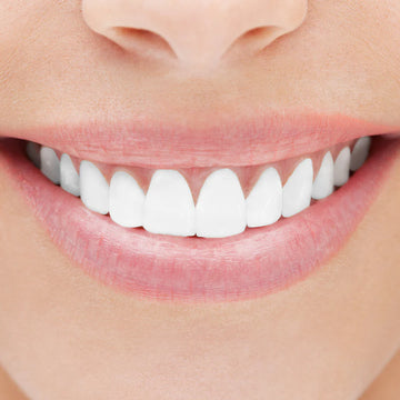 NeuraGlow LED Teeth Whitening Kit – Professional At-Home Teeth Whitening Device