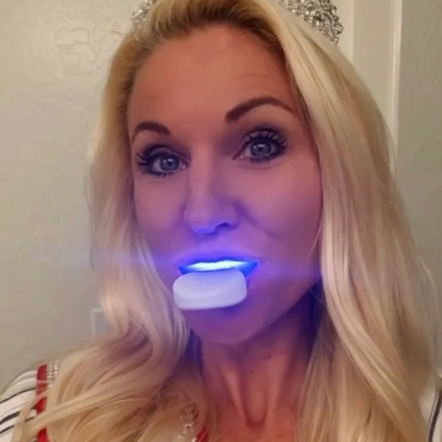 NeuraGlow smile care result